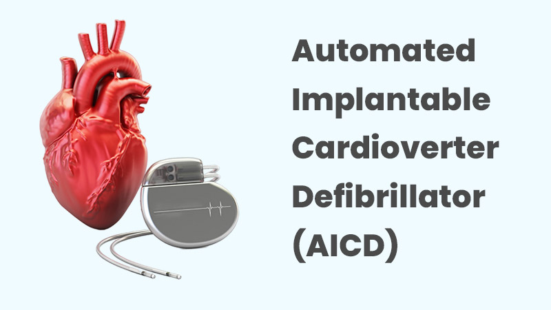 Automated Implantable Cardioverter Defibrillator