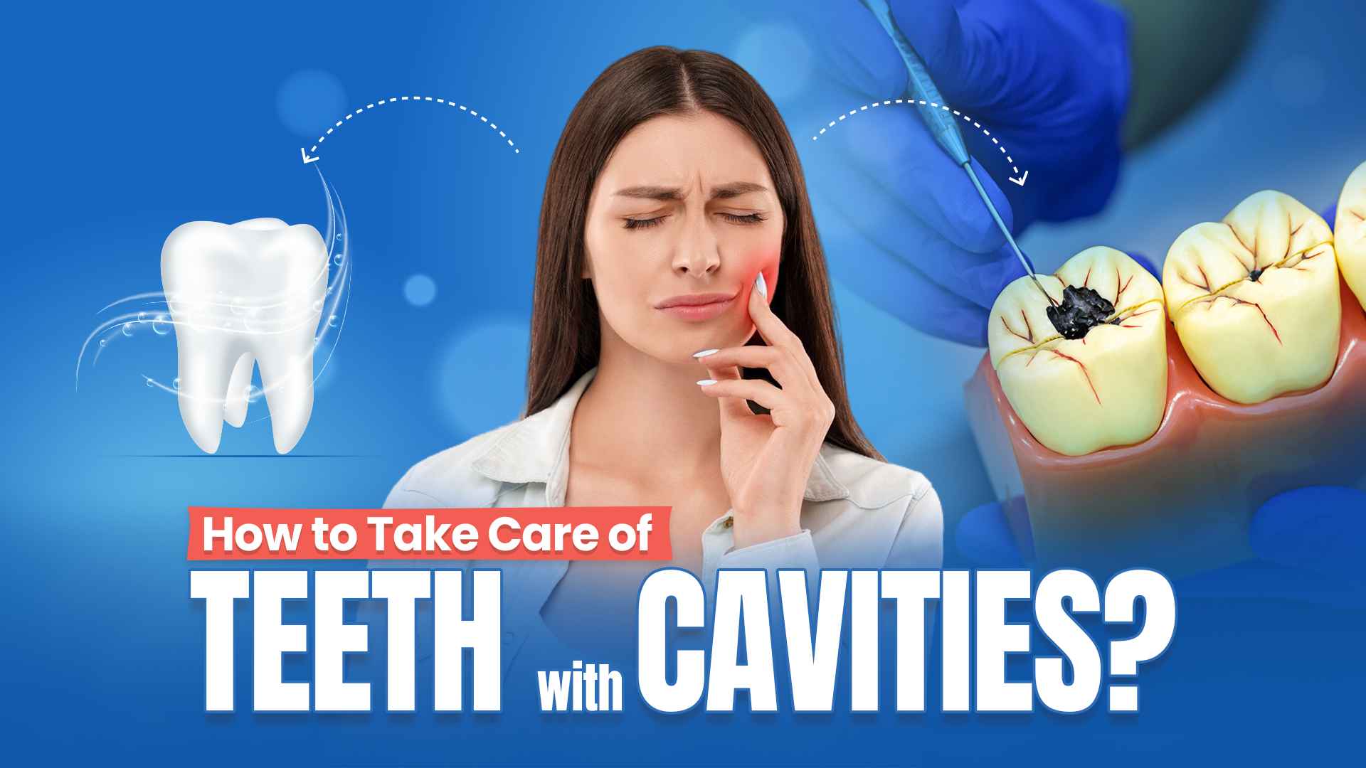How to take care of Teeth with Cavities?